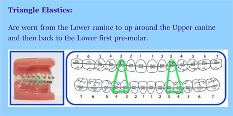 Triangle elastics | Elastic, Triangle, Pattern