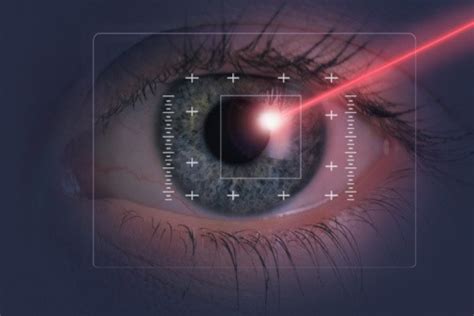 Femtosecond Laser Assisted Cataract Surgery at Melbourne Eye Centre