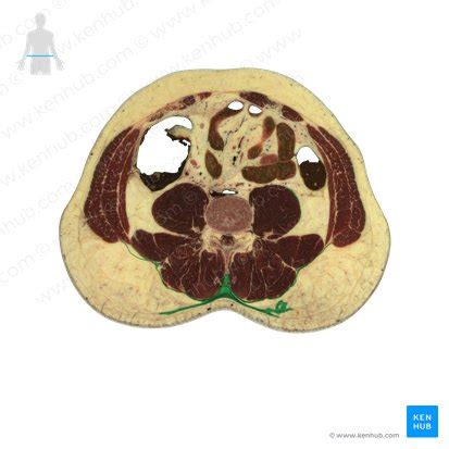 Thoracolumbar fascia: Anatomy and clinical notes | Kenhub