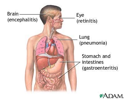 CMV (cytomegalovirus): MedlinePlus Medical Encyclopedia Image