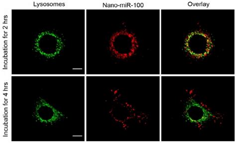 Confocal microscopy images of HN-13 cells stained by LysoTracker green ...