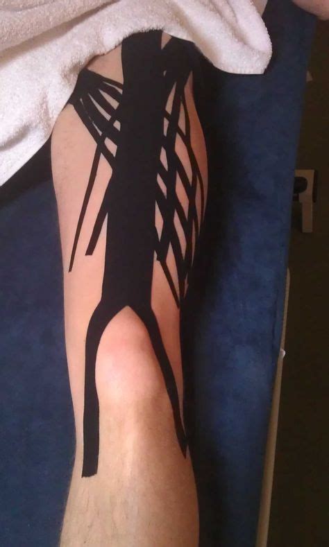 Kinesio taping above the knee. #orthoco #kinesio #kinesiotape #wellness #knee | Kinesio taping ...