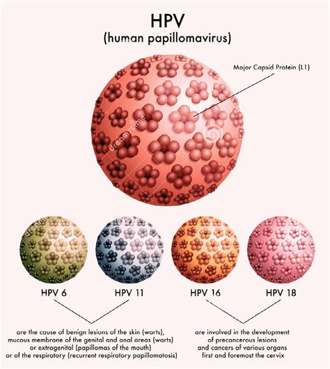 Cervical Cancer