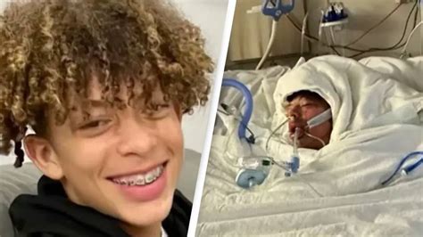 Teenager ‘unrecognizable’ after TikTok challenge left him with burns on 75% of his body