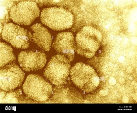 Smallpox virus microscope hi-res stock photography and images - Alamy