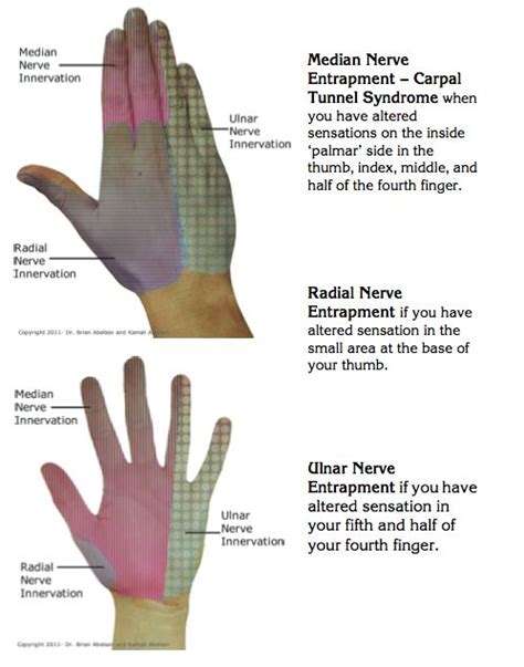 Exercises For Nerve Compression Syndromes Active Release - 499x635 ...