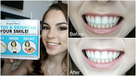 Does Brighter White Teeth Whitening Work - TeethWalls