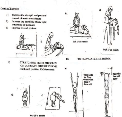 [PDF] A Review of Non-Invasive Treatment Interventions for Spinal ...