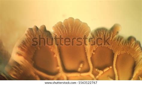 Bacterial Colonies Under Microscope Stock Photo 1563122767 | Shutterstock