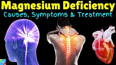 Magnesium Deficiency | Low Magnesium Symptoms | Hypomagnesemia – Symptoms, Causes & Treatment ...