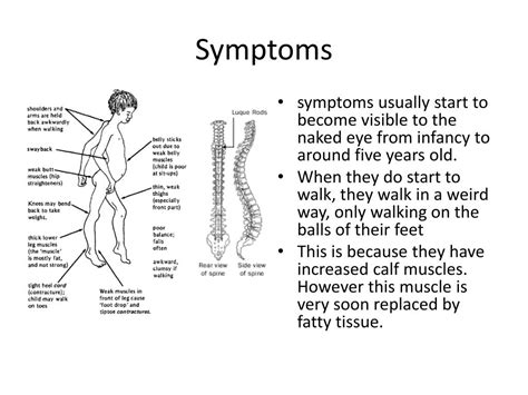 PPT - Duchenne Muscular Dystrophy PowerPoint Presentation, free download - ID:2211783