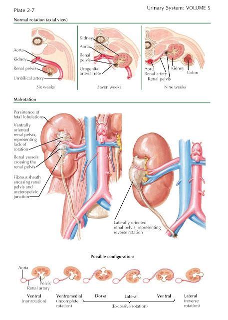 Renal Rotation And Malrotation NORMAL RENAL ROTATION During their normal process of ascent (see ...