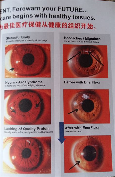 Iridology- diagnosis of past, present and future illness from the iris ...