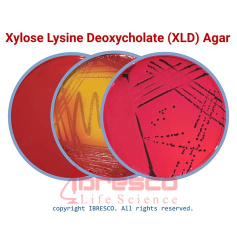 Xld Agar Results