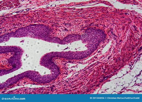 Human Transitional Epithelium Under the Microscope Stock Photo - Image of study, medicals: 201344056