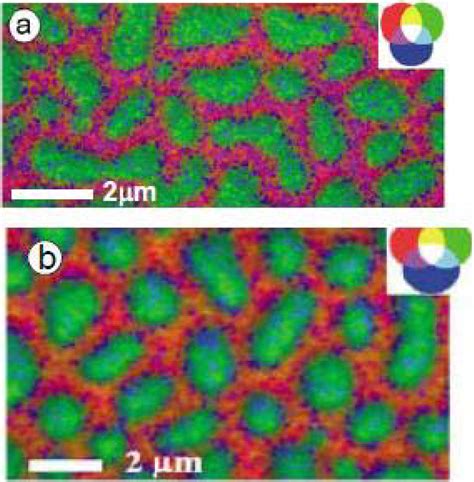 Materials | Special Issue : Advances in Biomaterials