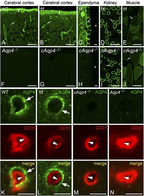 Glial-conditional deletion of aquaporin-4 (Aqp4) reduces blood–brain water uptake and confers ...