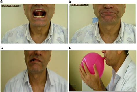 The effectiveness of oropharyngeal exercises compared to inspiratory muscle training in ...