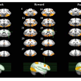 | Response inhibition associated brain regions. Brain activations... | Download Scientific Diagram