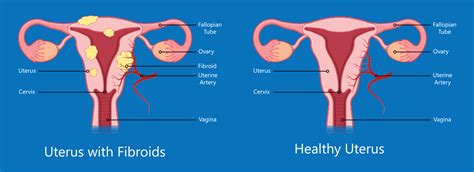 Interventional Radiology – Family Medicine Center