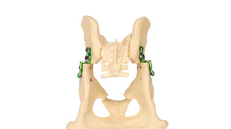 DPO - Double Pelvic Osteotomy | KYON