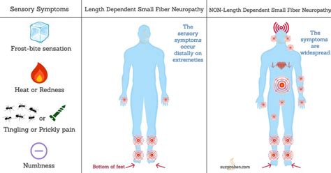 Small Fiber Neuropathy Causes and Treatment - Suzy Cohen suggests ways to heal naturally without ...