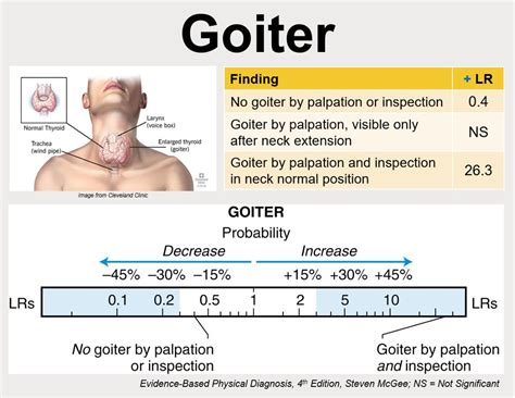 1/9 Let’s say you are about to do a thyroid exam. Before the exam you do not suspect goiter (pre ...