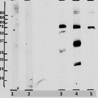 Figure. Results of SDS-PAGE immunoblotting. | Download Scientific Diagram