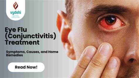 Eye Flu Treatment: Symptoms, Causes, and Home Remedies