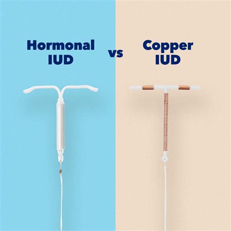 Copper Iud Vs Iud at Christopher Hess blog