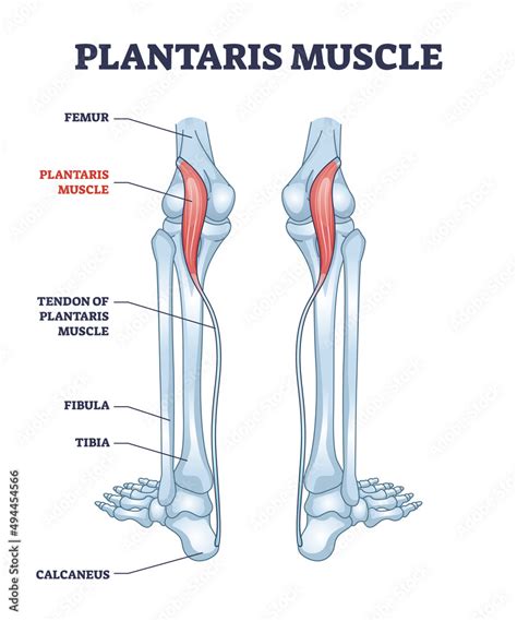 Plantaris muscle as leg superficial posterior compartment part outline diagram. Labeled ...