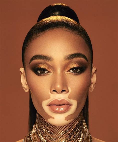 emo cunt⁷ on Twitter | Vitiligo model, Model face, Winnie harlow