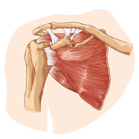 The Shoulder Joint: Impingement