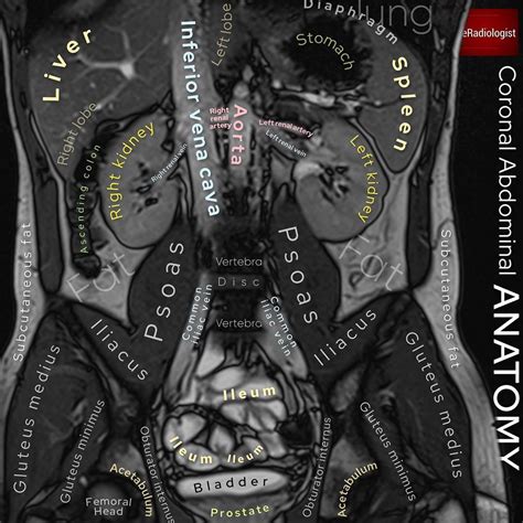 The Radiologist on Instagram: “CORONAL ABDOMINAL ANATOMY⁣⁣ ⁣⁣ 👨🏽‍💻Here ...