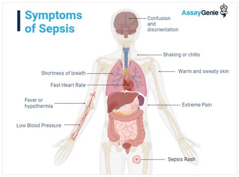 Biomarkers in sepsis: Their Role in Early Detection and Management ...