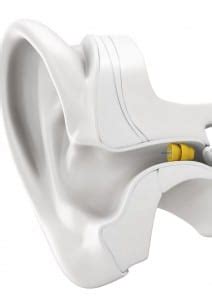 phonak hearing aid diagram visual - Diagram.