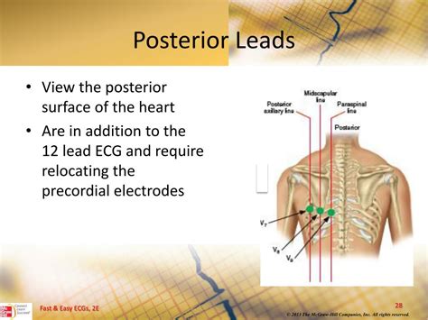 PPT - 12-Lead ECGs and Electrical Axis PowerPoint Presentation, free download - ID:5490745