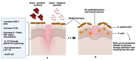 (A) shows normal flora/skin microbiome (S. epidermidis) on normal wound... | Download Scientific ...