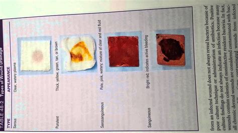 Fundamentals Types of Wound Drainage - YouTube