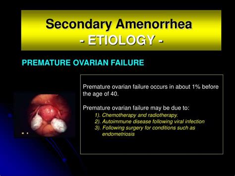 PPT - SECONDARY AMENORRHEA PowerPoint Presentation - ID:4428677