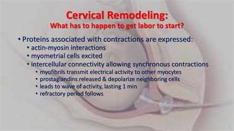 Cervical ripening