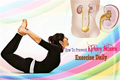 Top 12 Tips How To Prevent Kidney Stones From Forming Naturally