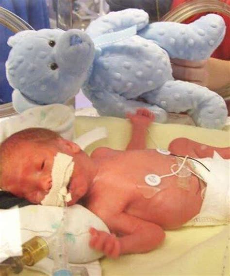 Twins Born at 28 weeks: Outlook And How to Cope - About Twins