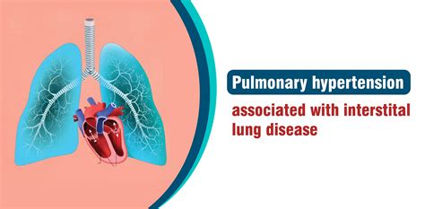 Pulmonary Hypertension associated with interstitial lung disease ...