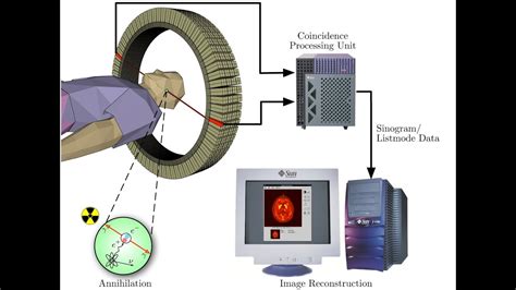 Pet Ct Scanner Pet Scan Works Does Imaging Scanner Tomography Positron ...