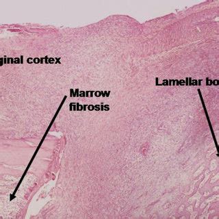 Histological cut showing details of lamellar bone concentrically... | Download Scientific Diagram