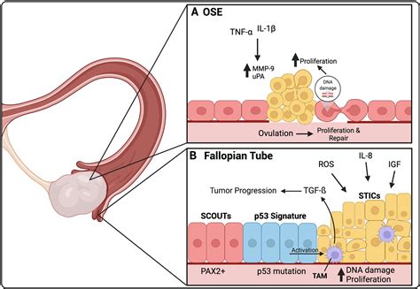 Frontiers | The Transcoelomic Ecosystem and Epithelial Ovarian Cancer Dissemination