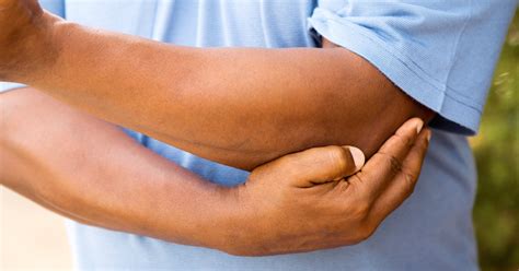 Gout in Elbow: What You Need to Know about Elbow Gout