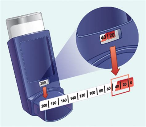 LUPIN | Albuterol Inhaler Help and Support