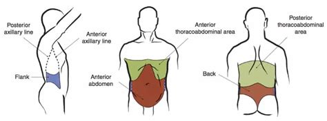 Abdominal Trauma: Blunt or penetrating • LITFL • CCC Trauma